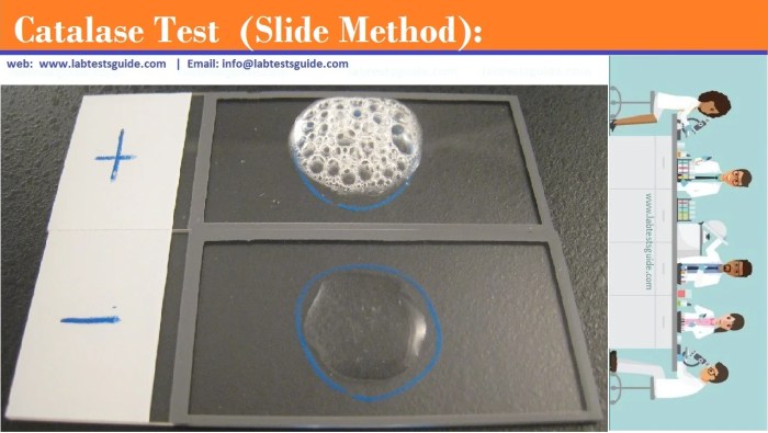 Catalase procedure labtestsguide